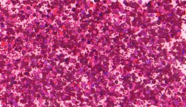 Preview: KNORRprandell Glitterfarbe Flaky Glue pink